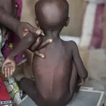 Food Security: UN allocates $20m to North East Nigeria